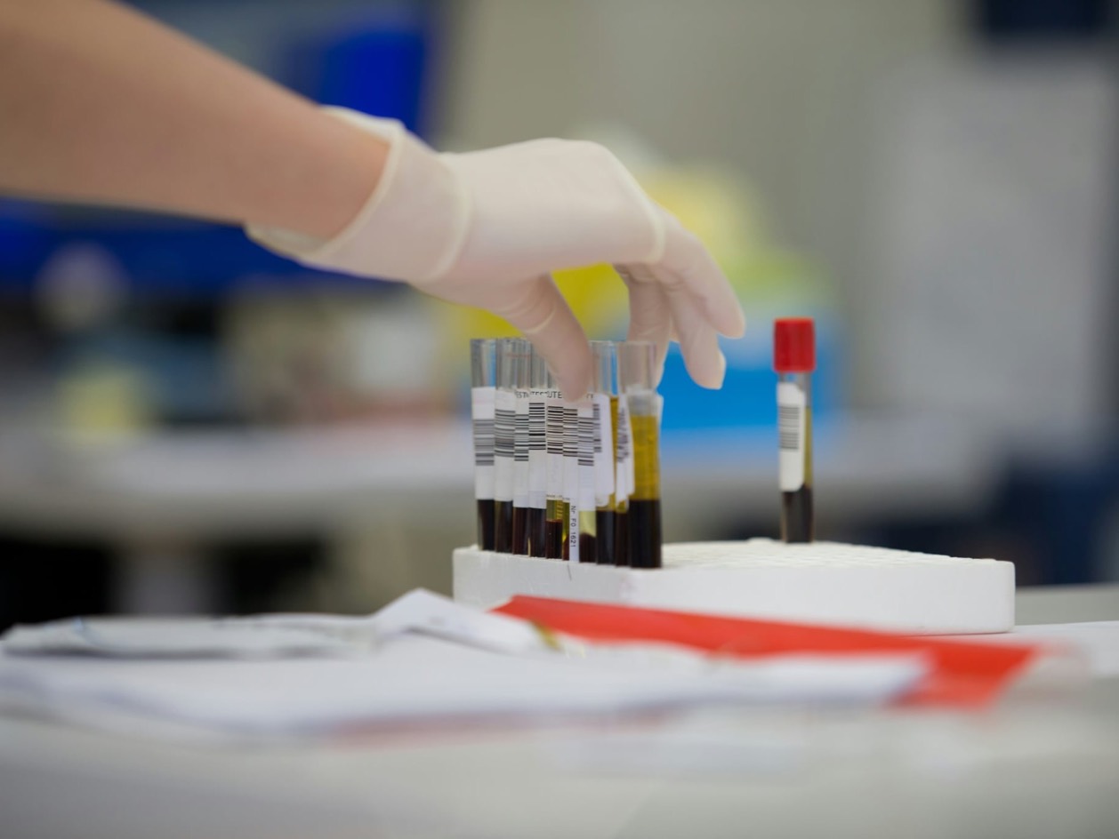 Gloved hand reaching for labelled blood sample tubes in a lab rack